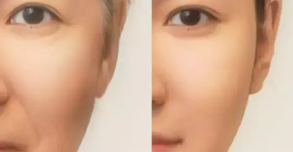 「大正製薬が、細胞の若返りの鍵「マイトリガーゼ」の肌での役割を世界で初めて解明」の画像