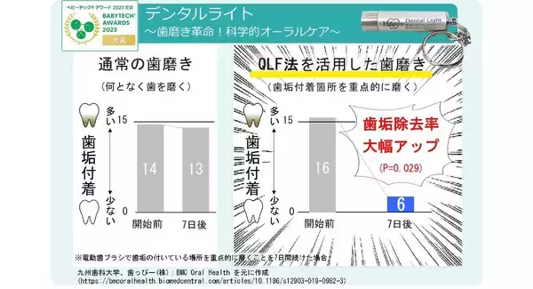 プラークを蛍光で可視化してチェック『デンタルライト』