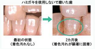 ライオンが本気で作った美白ハミガキ Lightee ライティー で顔の印象を明るくチェンジ 21年3月26日 エキサイトニュース 2 2