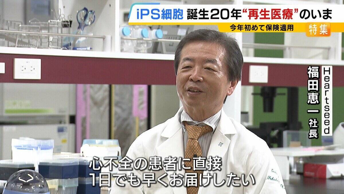 【iPS細胞】心臓病で“絶望”感じていた患者「問題なく生活できるように」　誕生から20年…高まる期待も「まだまだ道のり長い」究極の目的「広く普及させる」には？