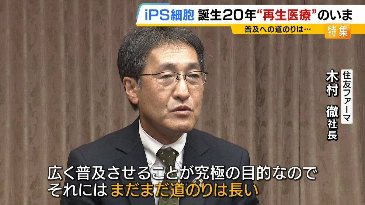 【iPS細胞】心臓病で“絶望”感じていた患者「問題なく生活できるように」　誕生から20年…高まる期待も「まだまだ道のり長い」究極の目的「広く普及させる」には？