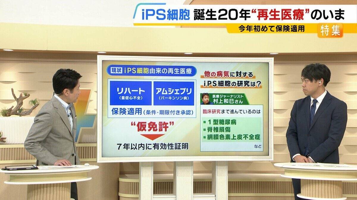 【iPS細胞】心臓病で“絶望”感じていた患者「問題なく生活できるように」　誕生から20年…高まる期待も「まだまだ道のり長い」究極の目的「広く普及させる」には？