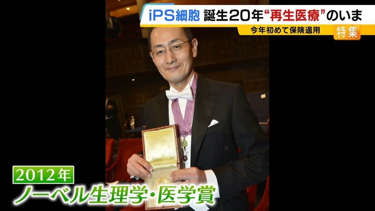 【iPS細胞】心臓病で“絶望”感じていた患者「問題なく生活できるように」　誕生から20年…高まる期待も「まだまだ道のり長い」究極の目的「広く普及させる」には？