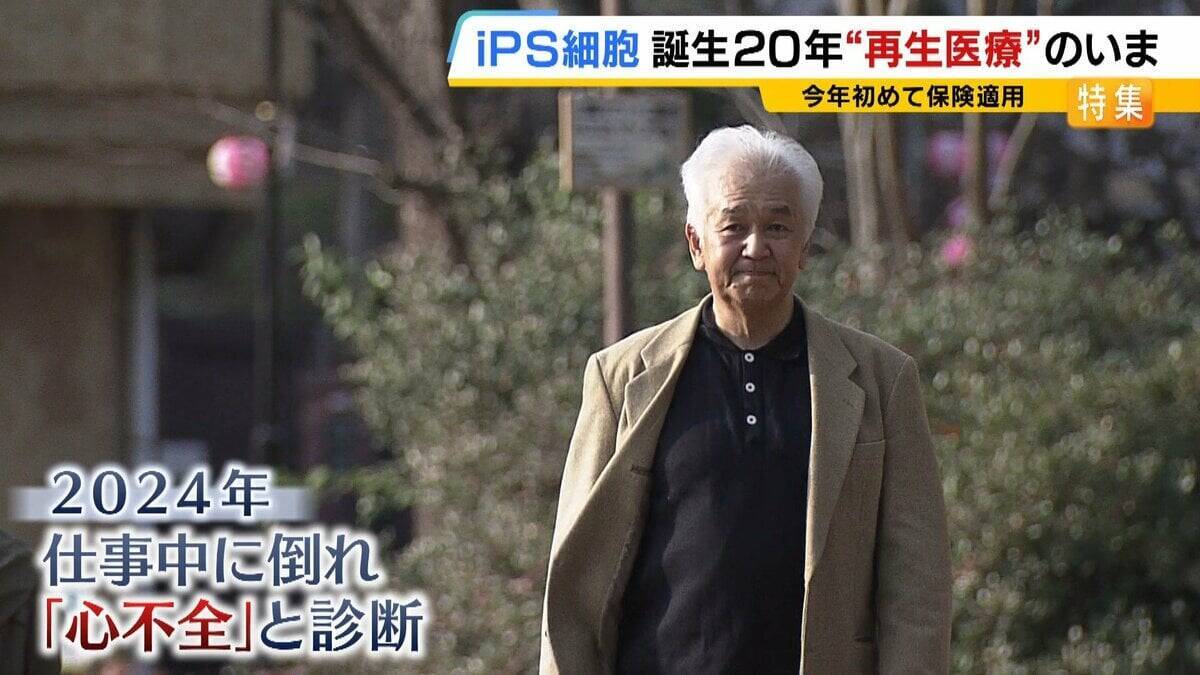 【iPS細胞】心臓病で“絶望”感じていた患者「問題なく生活できるように」　誕生から20年…高まる期待も「まだまだ道のり長い」究極の目的「広く普及させる」には？