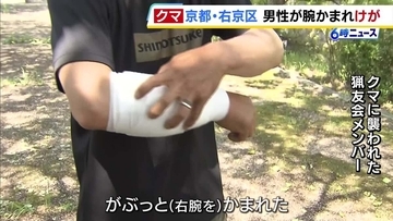 「逃げようと思ったらクマが目の前でグワーッと…」体長約1mのクマにかまれ７針縫った猟友会メンバーが証言　京都府内での人身被害は今年度初
