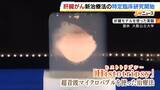 「衝撃波で腫瘍を破壊「メスも針も使わない」肝臓がんの新治療法　大阪公立大の研究チームが特定臨床研究を開始　来年中の薬事承認を目指す」の画像1
