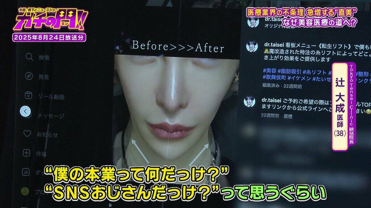 【急増！“直美”の実態】「美容整形は転生」自身の整形に約5000万円　タワマンでキラキラの私生活…『保険診療』人材不足の一因との指摘も【ガチの門】