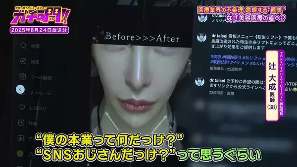 「【急増！“直美”の実態】「美容整形は転生」自身の整形に約5000万円　タワマンでキラキラの私生活…『保険診療』人材不足の一因との指摘も【ガチの門】」の画像