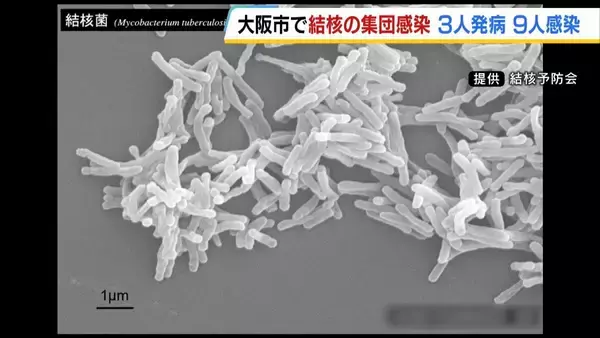 大阪市内で「結核」集団感染　日本語教育機関の関係者ら12人が感染・発病　咳や倦怠感などある場合は早期受診を呼びかけ