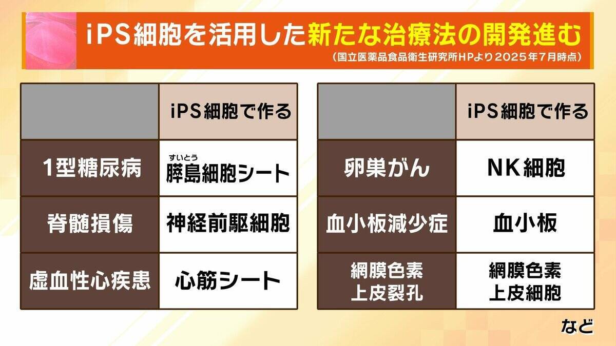 【iPS細胞】誕生から20年の時を経て実用化へ　細胞由来のパーキンソン病治療薬の保険適用了承　高まる期待も実は数々のハードルが…医療ジャーナリストが解説