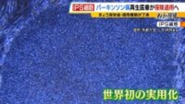 【iPS細胞】誕生から20年の時を経て実用化へ　細胞由来のパーキンソン病治療薬の保険適用了承　高まる期待も実は数々のハードルが…医療ジャーナリストが解説