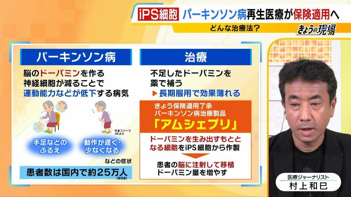 【iPS細胞】誕生から20年の時を経て実用化へ　細胞由来のパーキンソン病治療薬の保険適用了承　高まる期待も実は数々のハードルが…医療ジャーナリストが解説