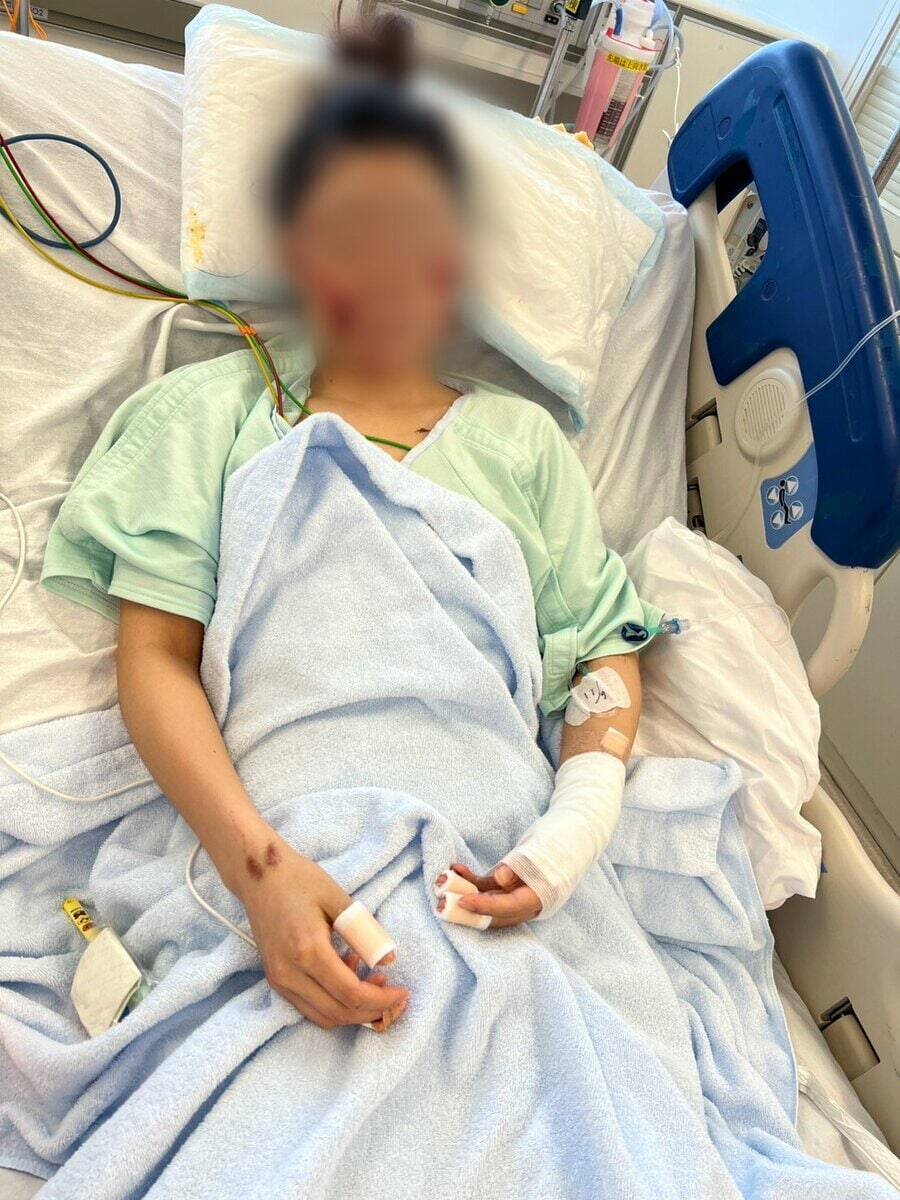 「地獄に突き落とされた感覚。こんな傷だらけになってしまって…」美容が好きだった20代女性　飲酒運転で二度と戻らなくなった顔と身体　念願の留学も白紙に…　被告の28歳女は酒に酔ったままハンドル握り…　危険運転致傷罪で起訴