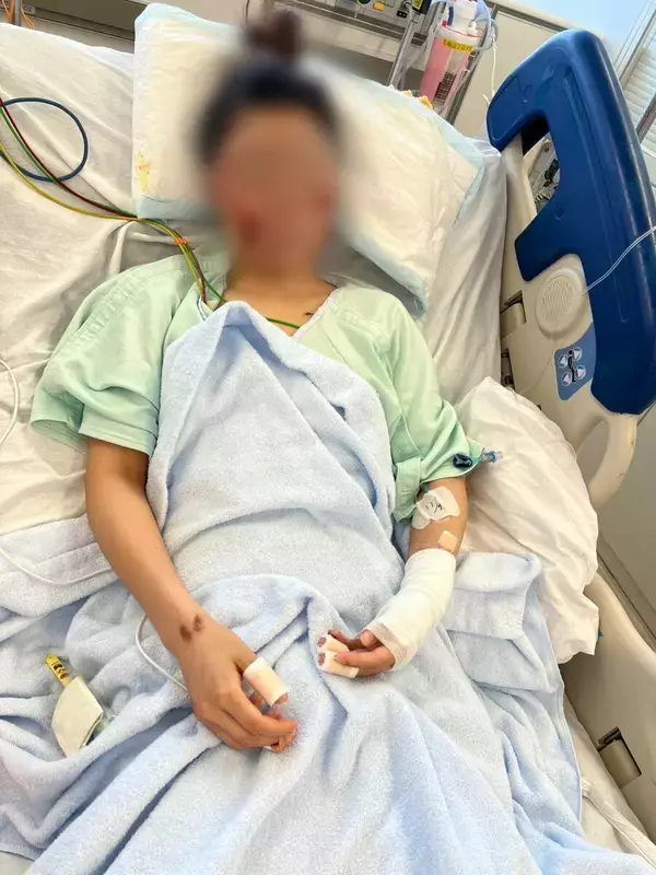 「「地獄に突き落とされた感覚。こんな傷だらけになってしまって…」美容が好きだった20代女性　飲酒運転で二度と戻らなくなった顔と身体　念願の留学も白紙に…　被告の28歳女は酒に酔ったままハンドル握り…　危険運転致傷罪で起訴」の画像