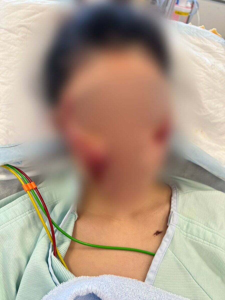 「地獄に突き落とされた感覚。こんな傷だらけになってしまって…」美容が好きだった20代女性　飲酒運転で二度と戻らなくなった顔と身体　念願の留学も白紙に…　被告の28歳女は酒に酔ったままハンドル握り…　危険運転致傷罪で起訴