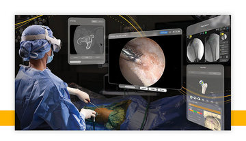 Stryker、FDA承認済みApple Vision Pro用手術アプリ「SportSuite Vision」を使用した股関節鏡手術の初症例を発表