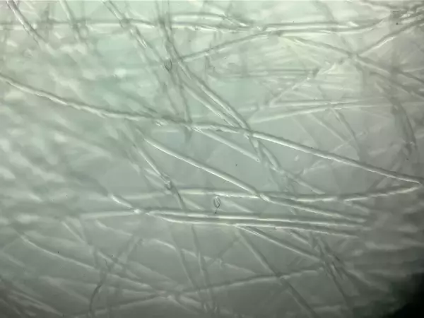 「レンズを装着するだけでスマホが顕微鏡になる「ミクロハンター」でアートのような世界を体験しよう！」の画像