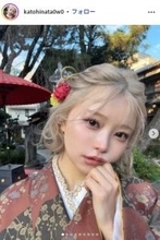 “B→Fカップにバストアップ”話題の美人YouTuber、歯列矯正のビフォアフ公開「別人級」「フェイスラインが違う」と驚きの声