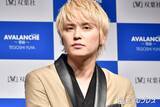「手越祐也、怪我を報告「めちゃくちゃ痛いし感覚なくなる」ケア中の写真も公開」の画像1