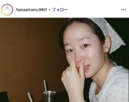 「ダウンタイム」天野はな「beforeもafterも特殊メイクです」整形役秘話投稿に反響「本物の整形かと思った」「リアルすぎる」の声