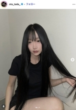 「月曜から夜ふかし」多田さん「残り10日で術後1ヶ月です」ノーマルカメラで整形DTの経過報告「強さに感動」「早く良くなりますように」と反響