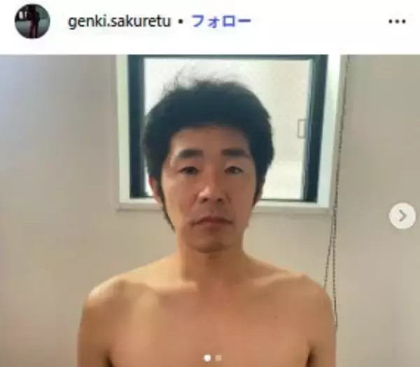 しずる池田一真、コンビ組んでいた人気歌手とは「次にあいつを見たのが渋谷の大画面」解散理由＆コンビ名明かす