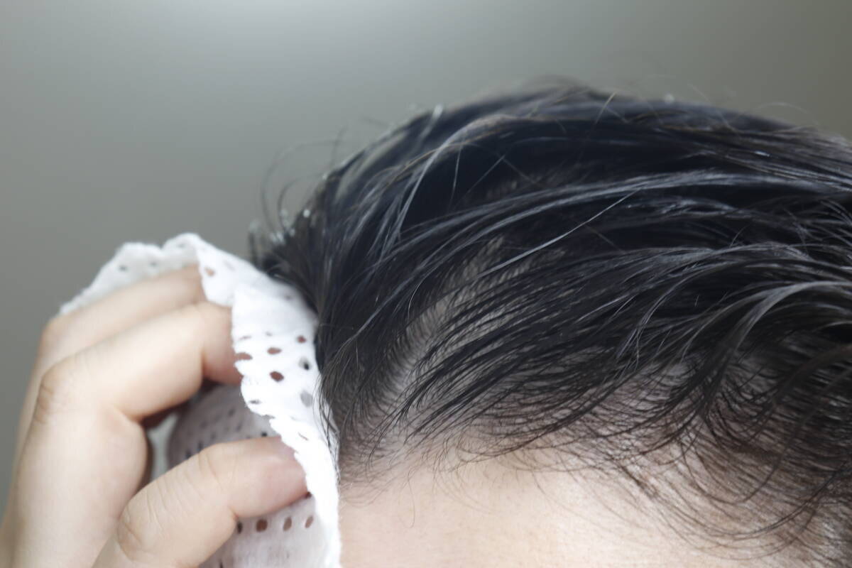 ダイソーで買えて助かった～！「頭ベタベタでニオイも気になる…」夏の悩みを解決できるシート
