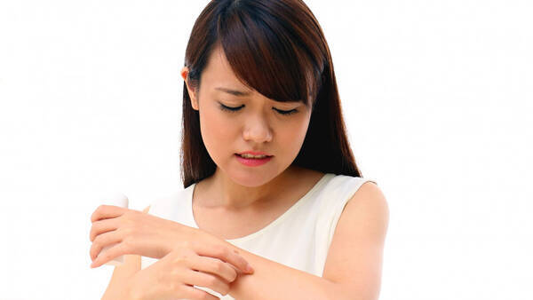 虫刺され 真っ赤になったり腫れたりするのはどうして 17年9月25日 エキサイトニュース 虫刺され 真っ赤になったり腫れたりするのはどうして 17年9月25日 エキサイトニュース