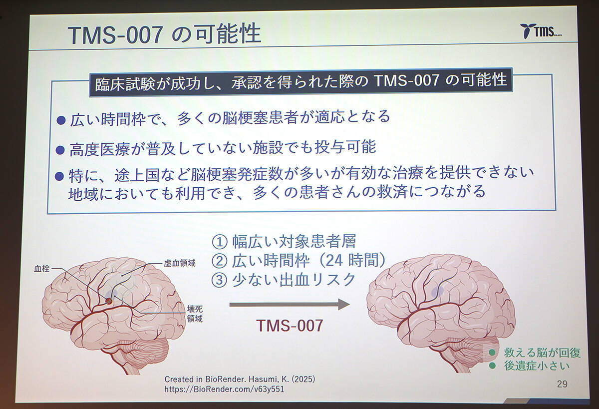 脳梗塞治療の未来を変えるか？ 創薬ベンチャー・ティムスが新薬候補「TMS-007」の可能性を発表