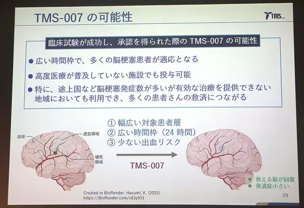 「脳梗塞治療の未来を変えるか？ 創薬ベンチャー・ティムスが新薬候補「TMS-007」の可能性を発表」の画像