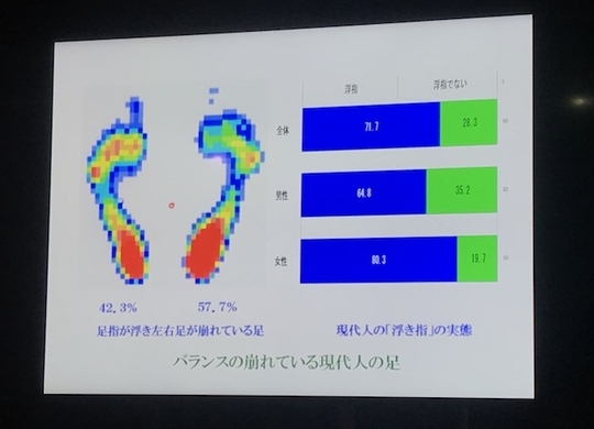 ネックレスが回る スカートが回る これって身体の歪み 15年4月28日 エキサイトニュース