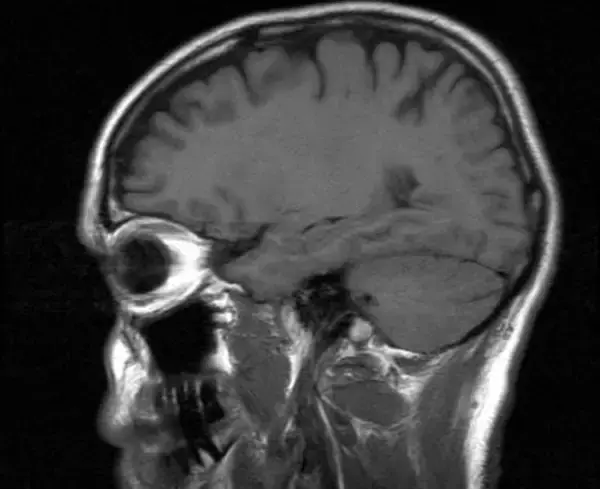 性的映像、脳にダメージ与え「ポル脳」に 脳が収縮し中毒化、ゾンビ状態へ