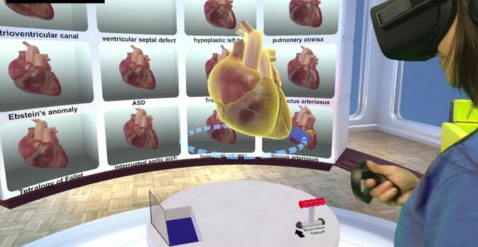 心臓を3dで詳細に観察 スタンフォード大が心臓病の治療を補助するvrツール開発 17年4月日 エキサイトニュース