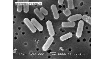 スポーツ強豪校・帝京長岡高校でウェルシュ菌による集団食中毒　50人に下痢や吐き気の症状…運動部員専用の食堂で提供された食事が原因　新潟・長岡市