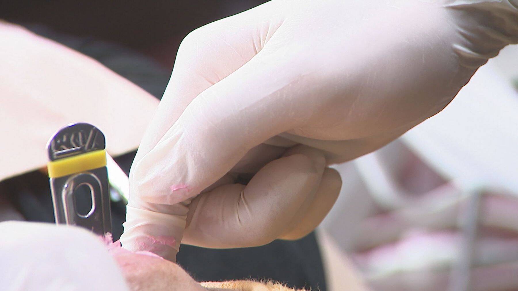 中東情勢“医療資材”にも影響…“石油製品”供給に不安抱える歯科医 1人で1日100枚消費するゴム手袋は「すでに値段上がり出荷制限も」