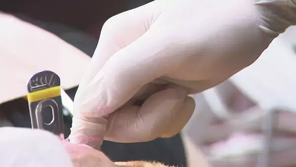 「中東情勢“医療資材”にも影響…“石油製品”供給に不安抱える歯科医 1人で1日100枚消費するゴム手袋は「すでに値段上がり出荷制限も」」の画像