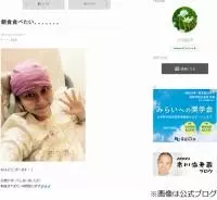 小林麻央 肺や骨へのがん転移を明かす ステージはどこまで進行しているのか 16年9月日 エキサイトニュース