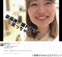 指原莉乃 広田レオナに Akb整形疑惑 を持ち出され 私からは何とも 17年5月4日 エキサイトニュース