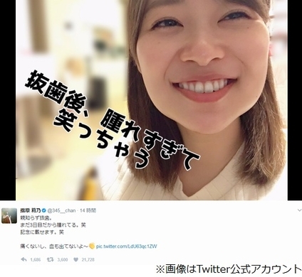 顔相鑑定 指原莉乃が どんどんキレイになっているワケ 19年6月4日 エキサイトニュース