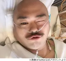 海原やすよが脳動脈瘤手術へ、苦渋の決断にあった壮絶プロ意識 (2016年12月26日) - エキサイトニュース