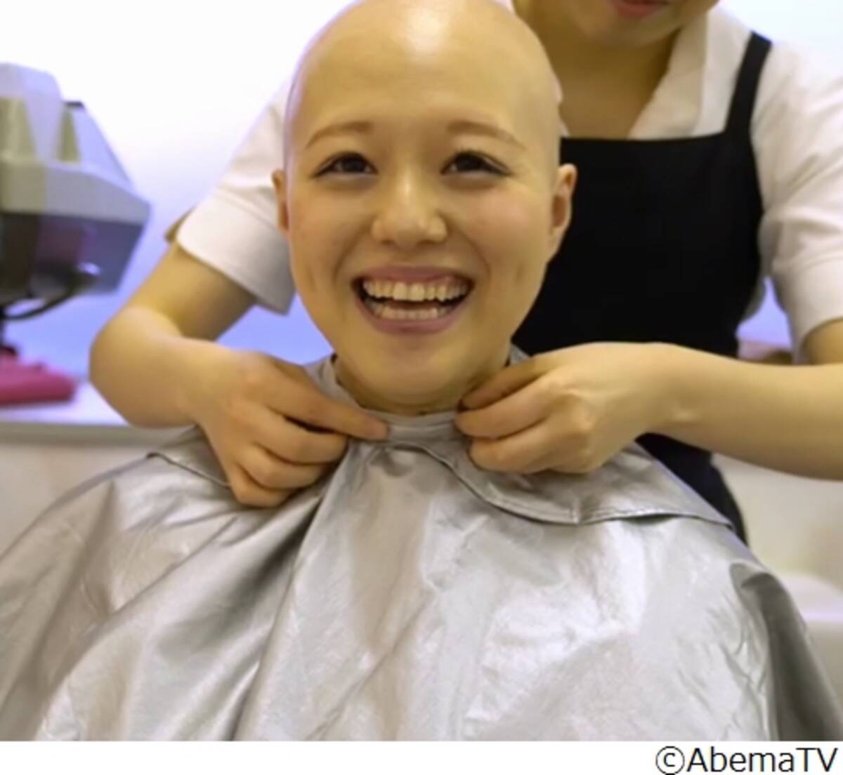 全身脱毛症 公表アイドルの密着に反響 19年6月14日 エキサイトニュース