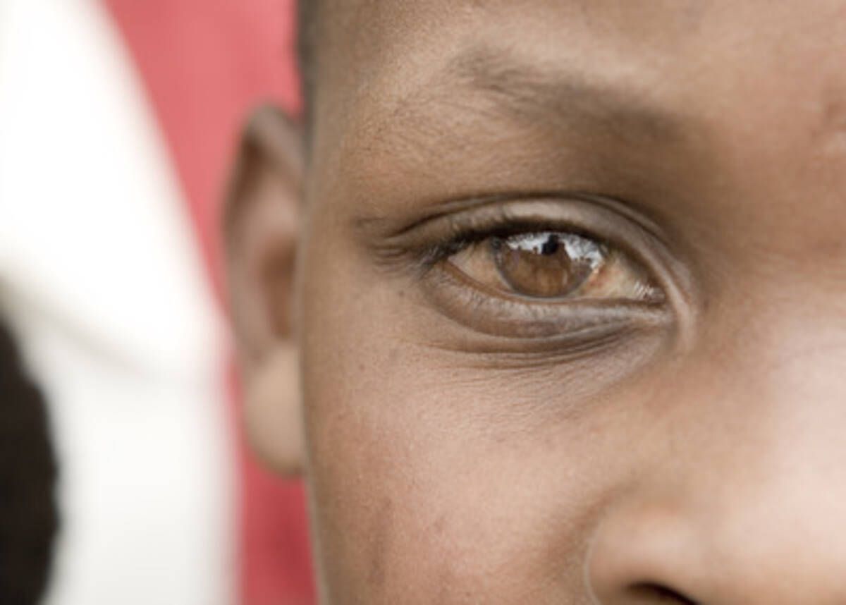 アフリカ人は目が良い はウソだった 紫外線が眼に与える影響が明らかに 15年3月12日 エキサイトニュース