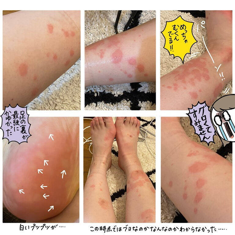 【ヤバい虫の悪夢⑥】ついに痒みが限界突破！我を忘れて取った「謎行動」がカオス過ぎた話【momo漫画】
