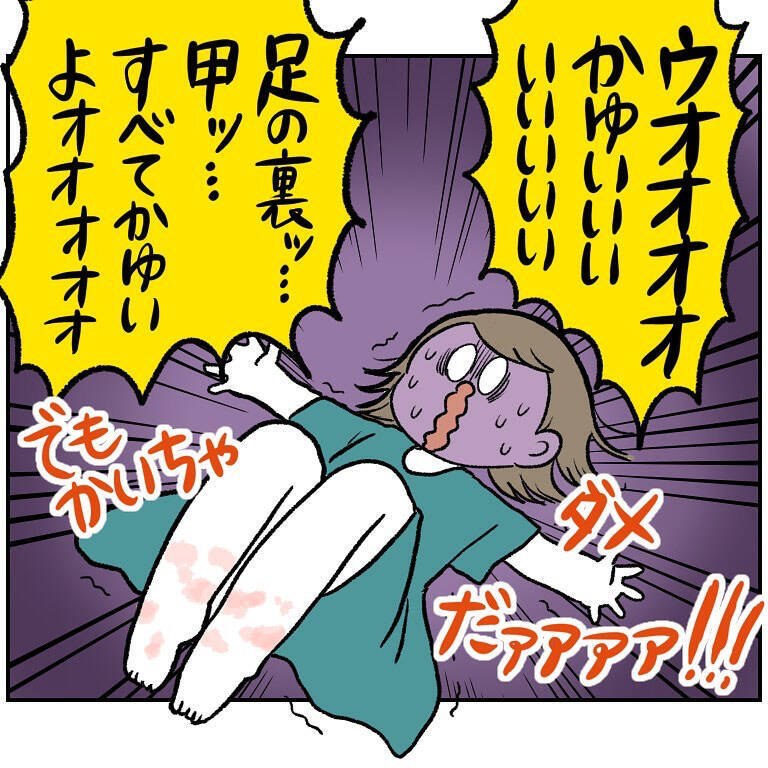 【ヤバい虫の悪夢⑥】ついに痒みが限界突破！我を忘れて取った「謎行動」がカオス過ぎた話【momo漫画】