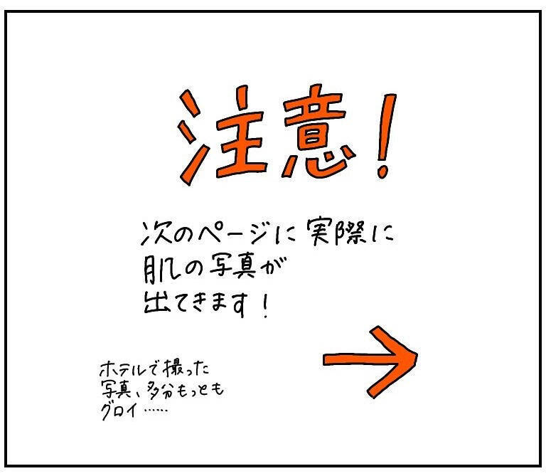 【ヤバい虫の悪夢⑥】ついに痒みが限界突破！我を忘れて取った「謎行動」がカオス過ぎた話【momo漫画】