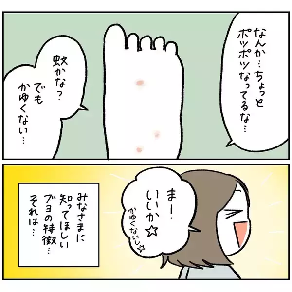 「【ヤバい虫の悪夢②】虫に刺されたけど全然かゆくな～い♪放置した結果…現れし症状とは!?【momo漫画】」の画像