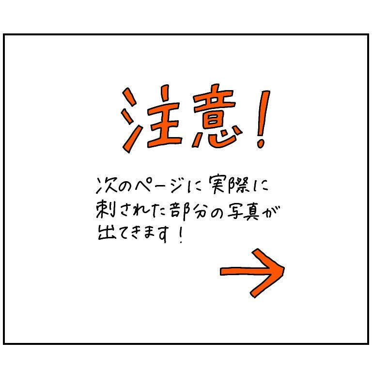 【ヤバい虫の悪夢②】虫に刺されたけど全然かゆくな～い♪放置した結果…現れし症状とは!?【momo漫画】