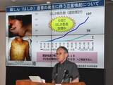 「沖縄で今年初のはしか確認　知事が注意喚起　全国で急増、ワクチン2回接種を」の画像1