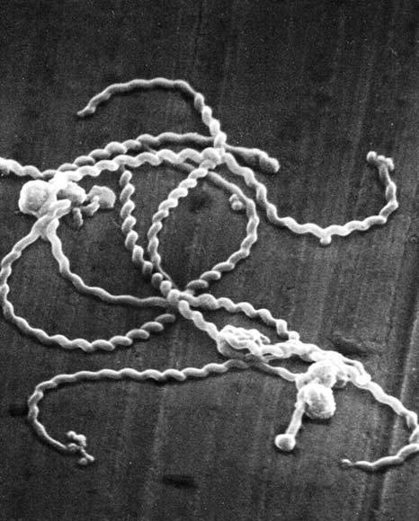 沖縄・石垣島で「レプトスピラ症」5人が集団感染　同じ川で泳ぎ発熱や結膜充血　重症化すると腎機能障害も