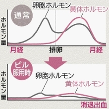イライラや倦怠感、頭痛…　月経前症候群の症状　ピルや漢方薬で症状緩和